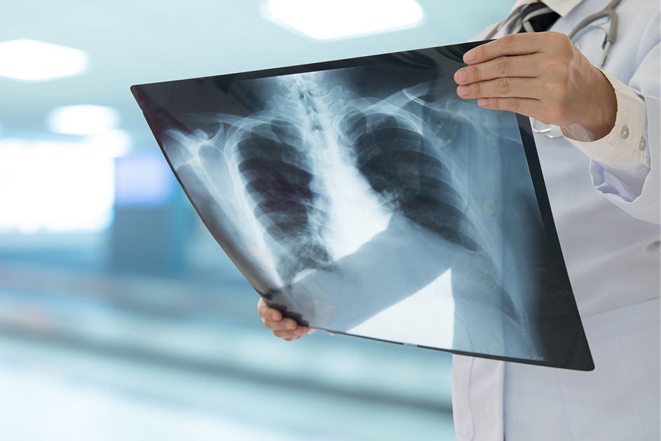 A medical specialist examines a chest scan for signs of disease